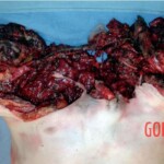 Man committed suicide with explosive