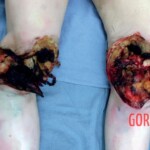 Man committed suicide with explosive