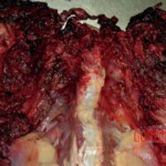 Man committed suicide with explosive