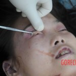 Murdered Chinese teen found in woods