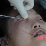 Murdered Chinese teen found in woods