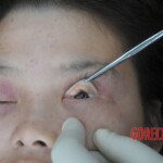 Murdered Chinese teen found in woods