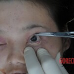 Murdered Chinese teen found in woods