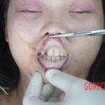 Murdered Chinese teen found in woods