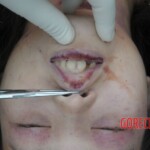 Murdered Chinese teen found in woods