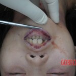 Murdered Chinese teen found in woods