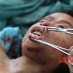 Post-mortem examination of female car accident victim