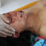 Post-mortem examination of female car accident victim