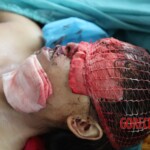 Post-mortem examination of female car accident victim