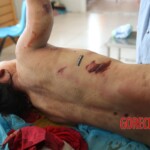 Post-mortem examination of female car accident victim