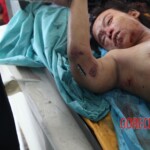 Post-mortem examination of female car accident victim