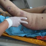 Post-mortem examination of female car accident victim