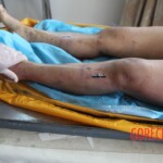 Post-mortem examination of female car accident victim