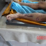 Post-mortem examination of female car accident victim