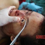 Post-mortem examination of female car accident victim