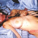 Stabbed to death with BBQ fork