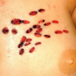 Stabbed to death with BBQ fork