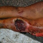 Woman dragged by vehicle for more than 1 mile