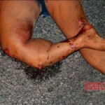 Woman dragged by vehicle for more than 1 mile