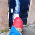 Young thief has his ankle pierced through fence