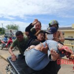 Young woman's leg is crushed by concrete mixer truck