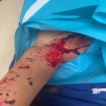 Aftermath of collision between two trams in Strasbourg