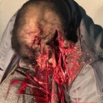 Erinaldo Ferreira da Silva