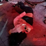 Chinese girl got burnt by throwing fireworks in the sewer well