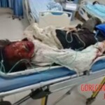 Chinese girl got burnt by throwing fireworks in the sewer well