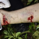 Chinese woman attacked by maniac on her way home from work