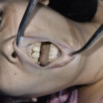 Chinese woman attacked by maniac on her way home from work