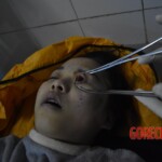Young Chinese woman in morgue