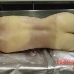 Determination of time of death according to rigor mortis