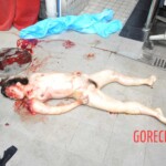 Examination of female suicidal jumper