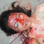 Examination of female suicidal jumper