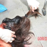 Examination of female suicidal jumper