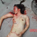 Examination of female suicidal jumper