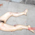 Examination of female suicidal jumper