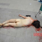 Examination of female suicidal jumper