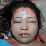 Examination of female suicidal jumper