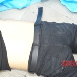 Examination of female suicidal jumper