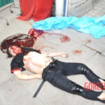 Examination of female suicidal jumper