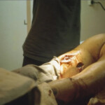 Vietnam war injury