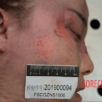 Murdered and stuffed in suitcase