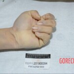 Murdered and stuffed in suitcase