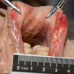 Murdered and stuffed in suitcase