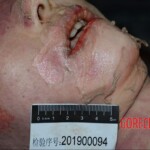 Murdered and stuffed in suitcase