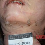 Murdered and stuffed in suitcase