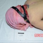 Murdered and stuffed in suitcase