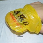 Murdered and stuffed in suitcase